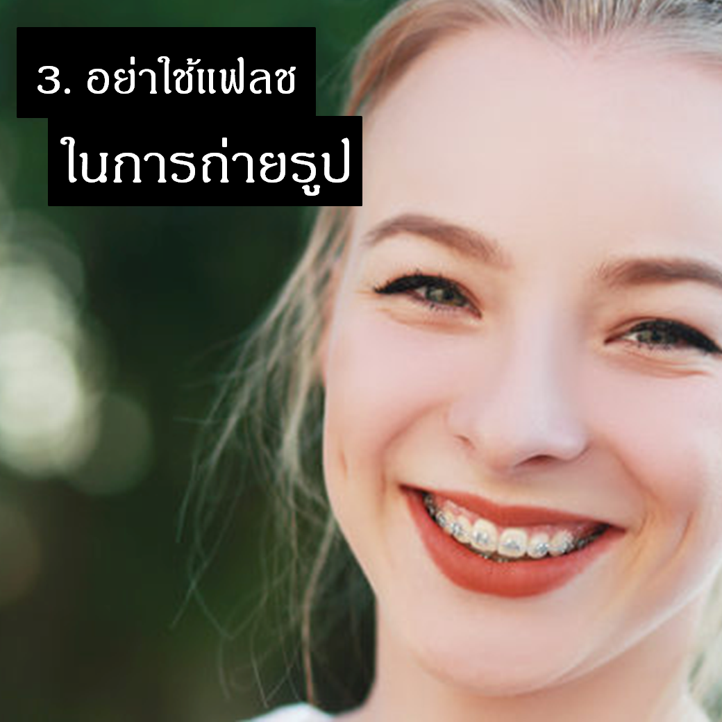 เคล็ดลับการถ่ายรูปสำหรับคนจัดฟันข้อที่สาม คนจัดฟันต้องอย่าใช้แฟลชในการถ่ายรูป