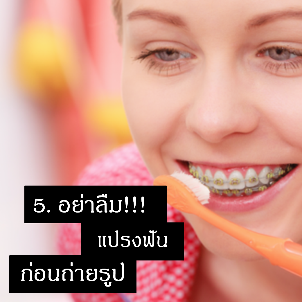 เคล็ดลับการถ่ายรูปสำหรับคนจัดฟันข้อที่ห้า คืออย่าลืมแปรงฟันก่อนถ่ายรูป
