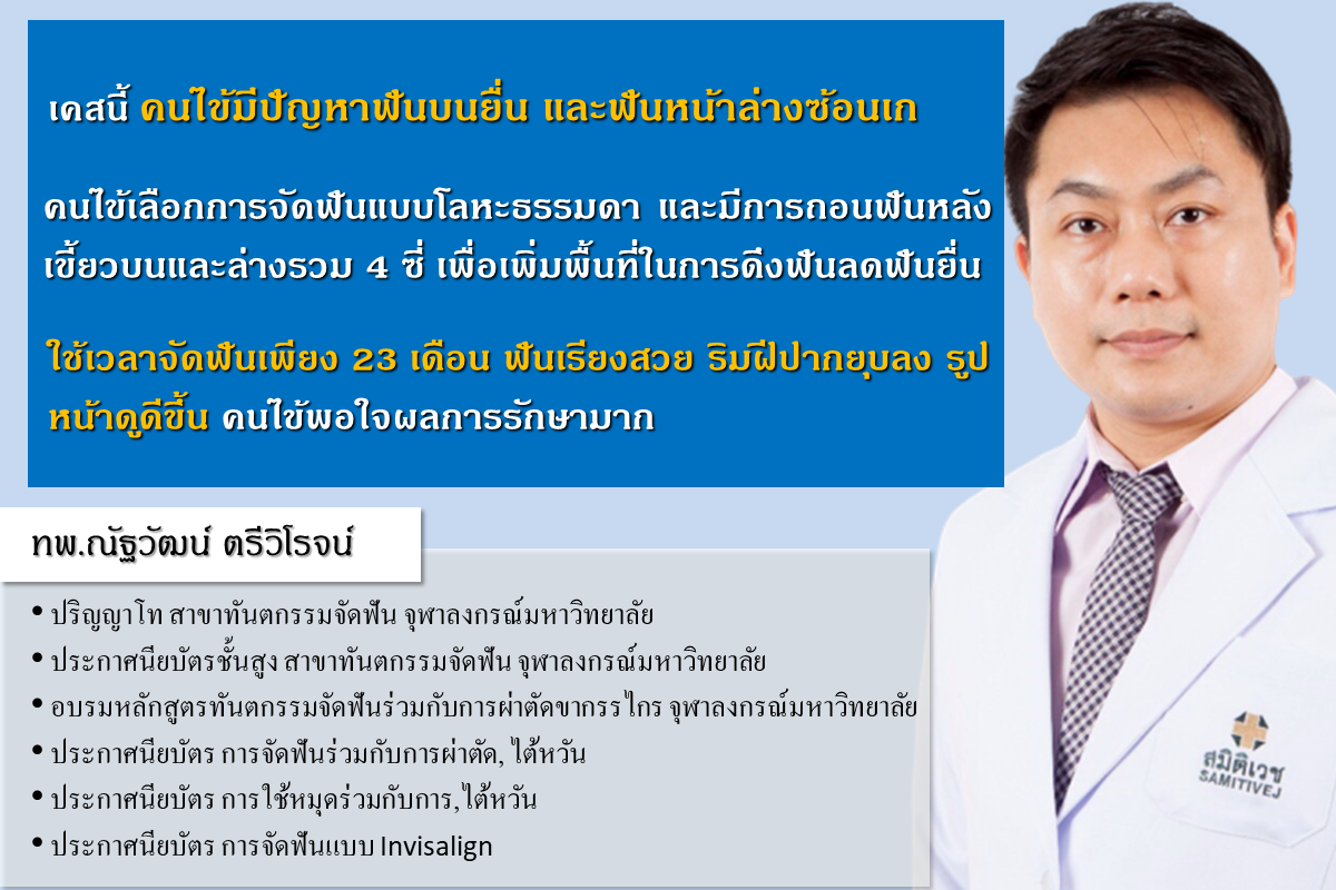 จัดฟันโดยทันตแพทย์เฉพาะทางรัชดาห้วยขวาง