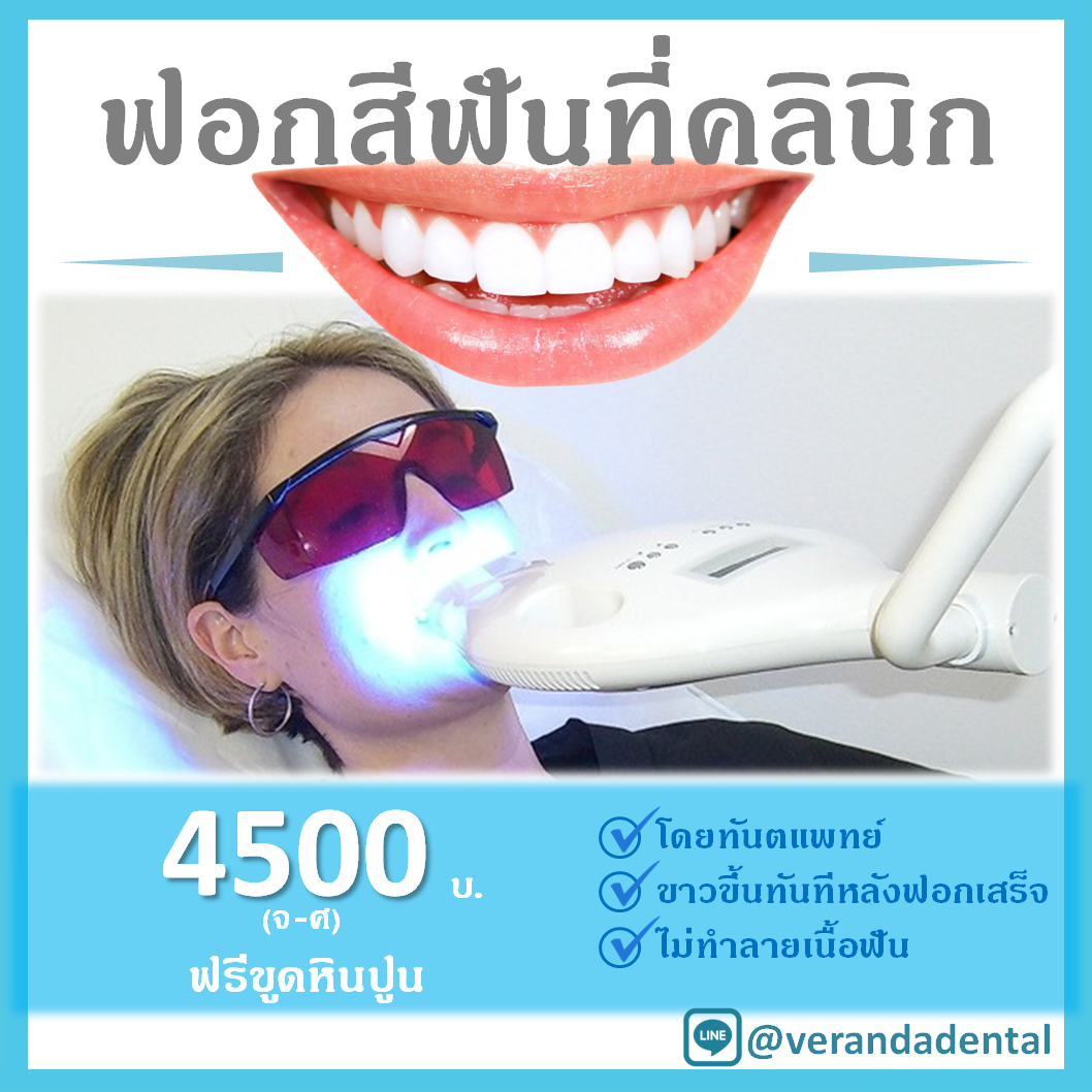 โปรโมชั่นฟอกฟันขาว