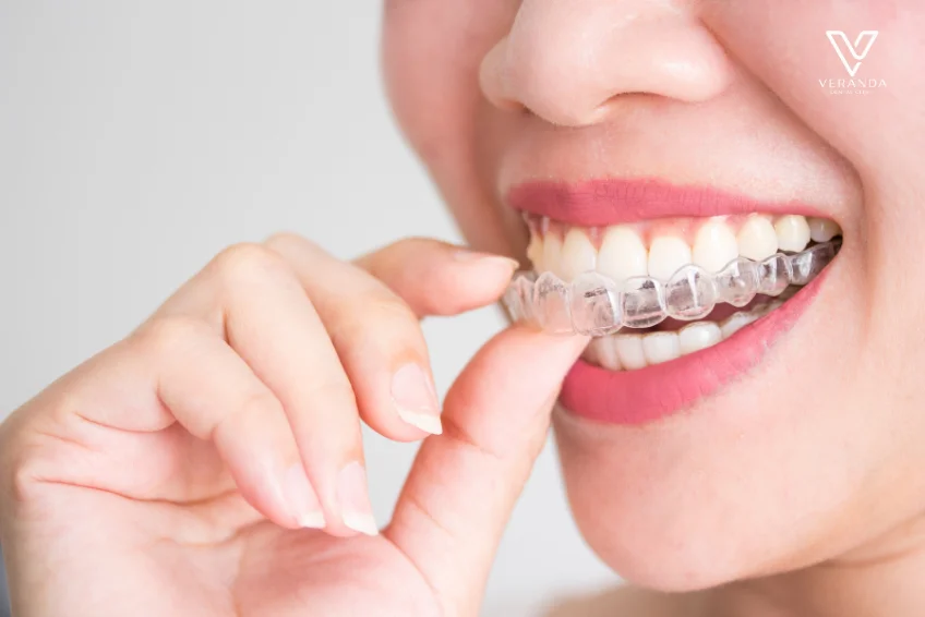 โปรโมชันจัดฟันใสที่ Veranda Dental Clinic