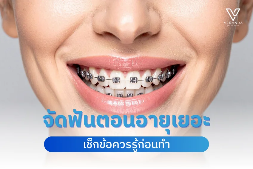 จัดฟันตอนอายุเยอะ ทำได้ไหม