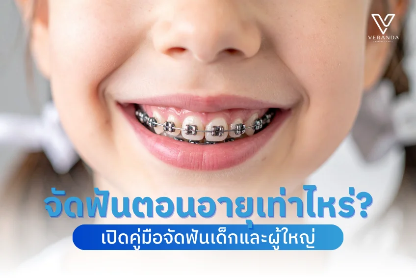 ควรจัดฟันตอนอายุเท่าไหร่