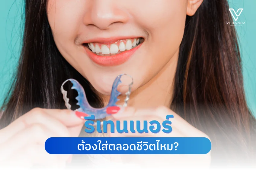 รีเทนเนอร์ต้องใส่ตลอดชีวิตไหม