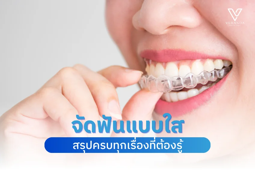 จัดฟันแบบใส Clear Aligner