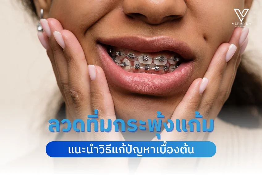 ลวดทิ่มกระพุ้งแก้มระหว่างจัดฟัน